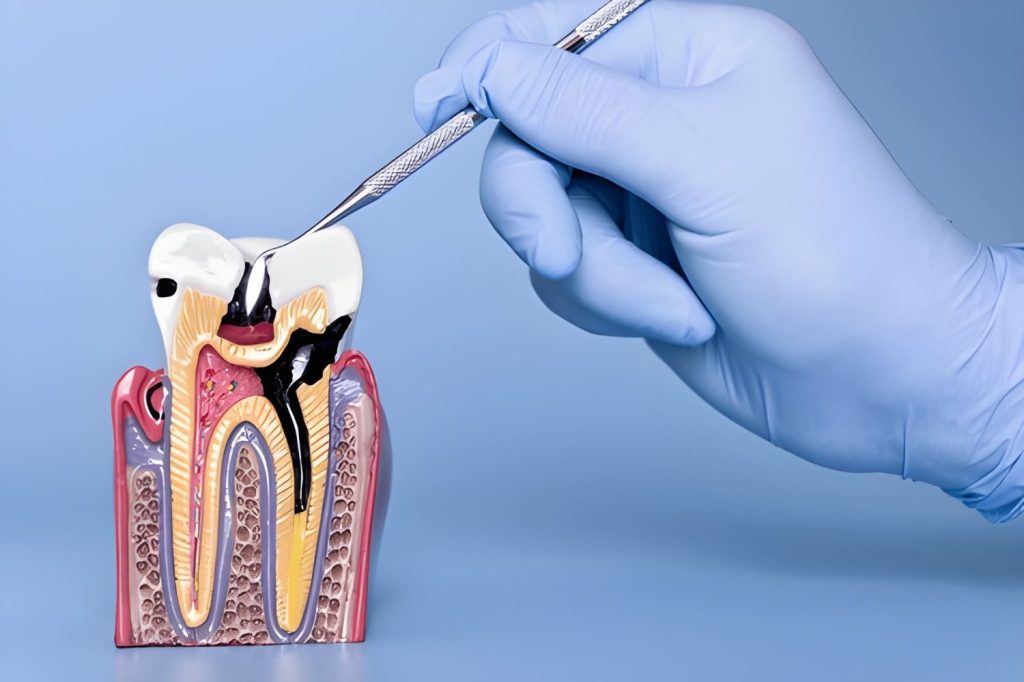 dental infection treatment in calgary