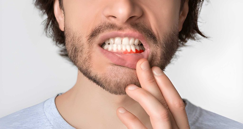 gum infection treatment in calgary