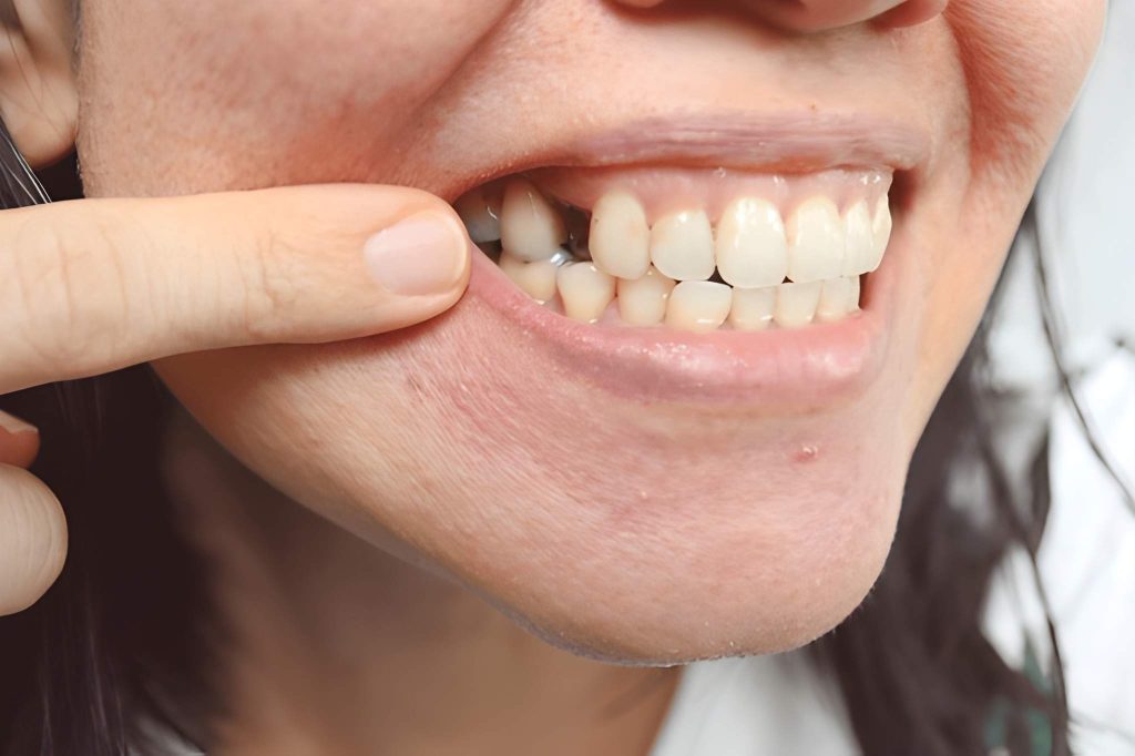 knocked out tooth treatment in calgary